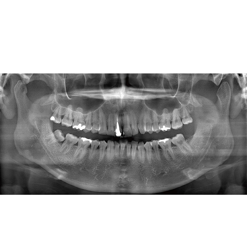 Flexdental