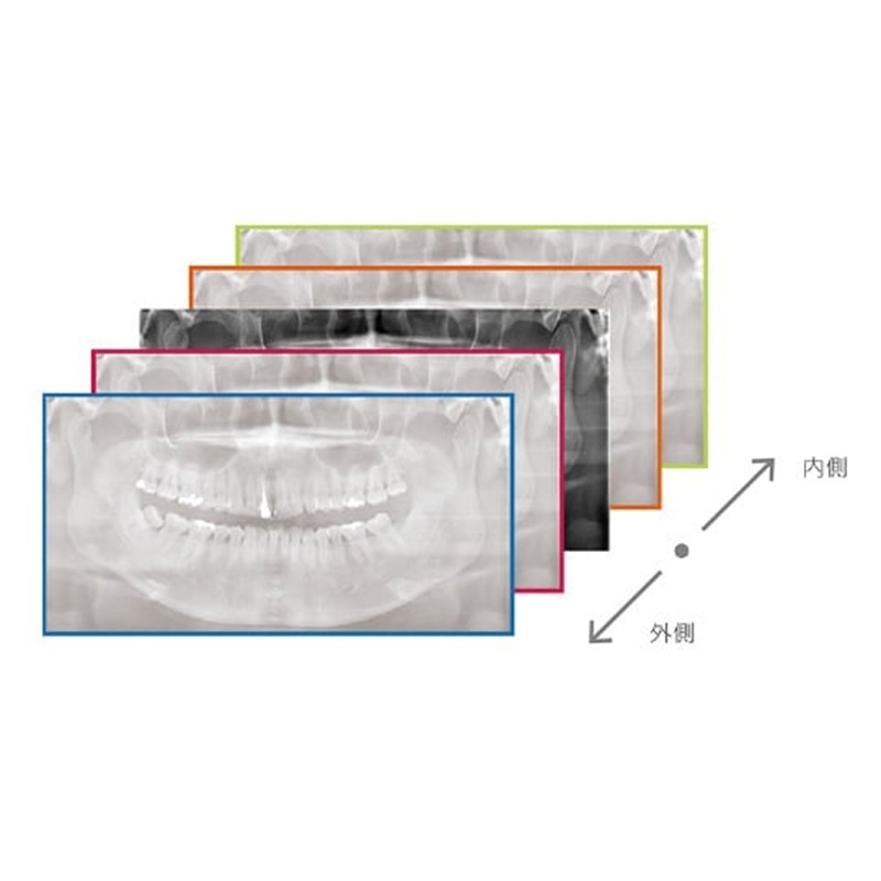 Flexdental