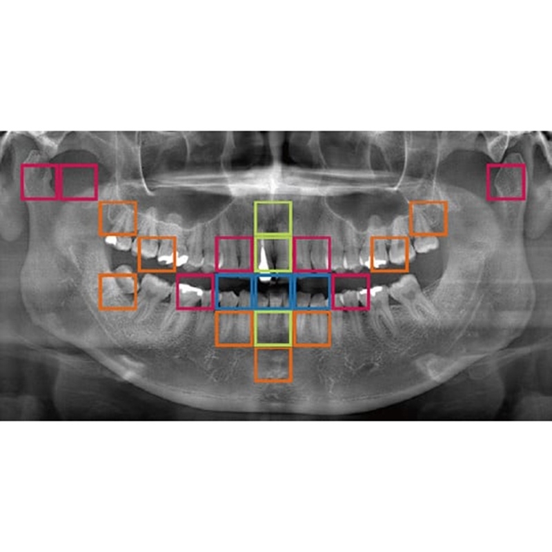 Flexdental