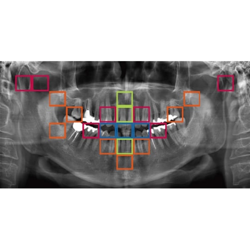 Flexdental