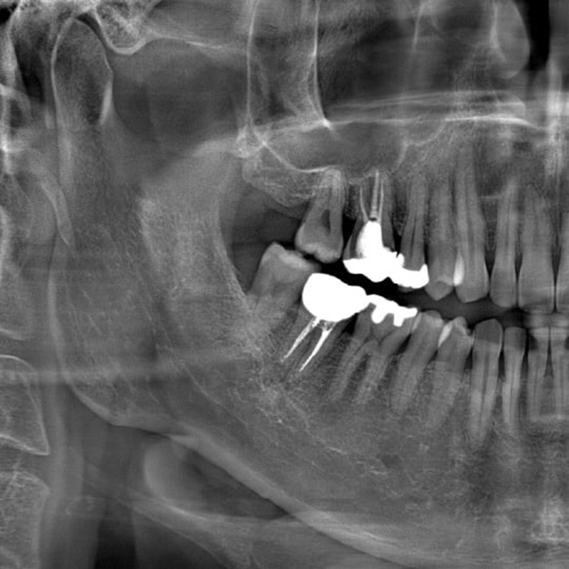 Flexdental