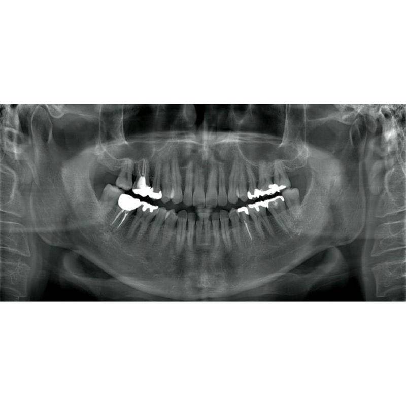 Flexdental