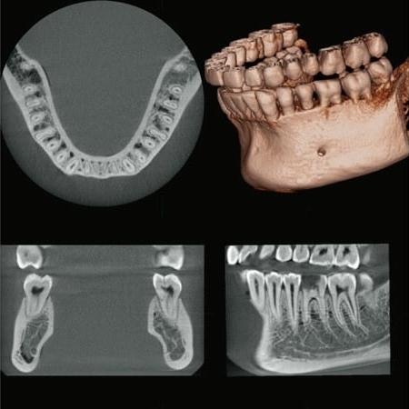 Flexdental