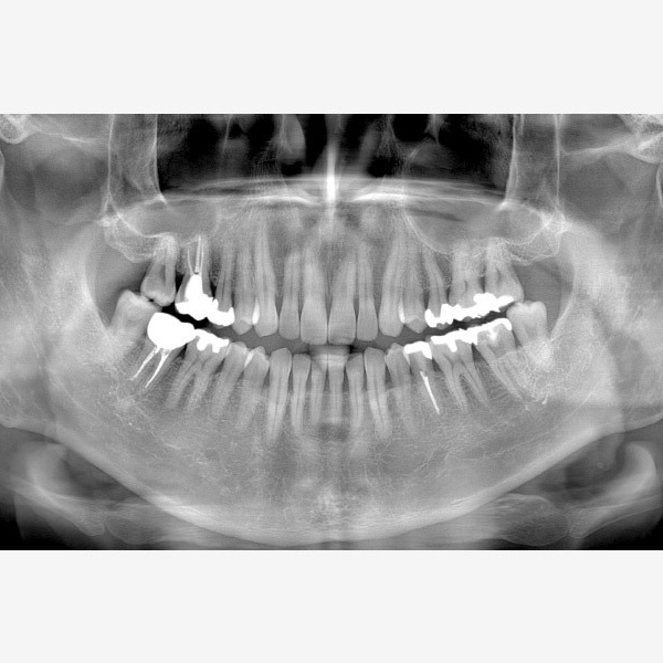 Flexdental