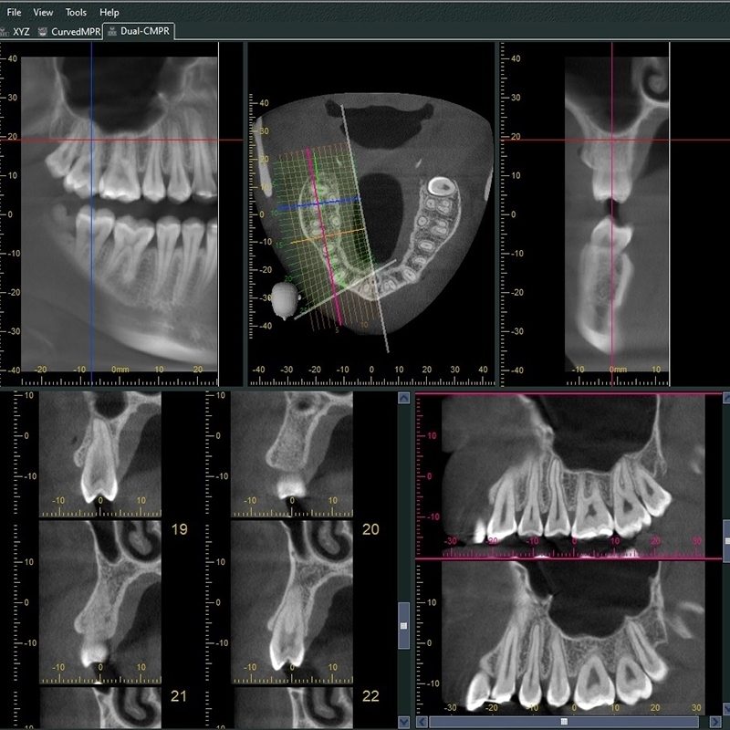 Flexdental