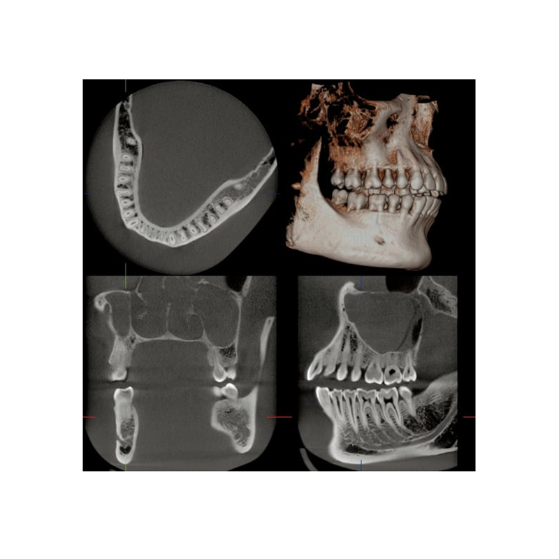 Flexdental